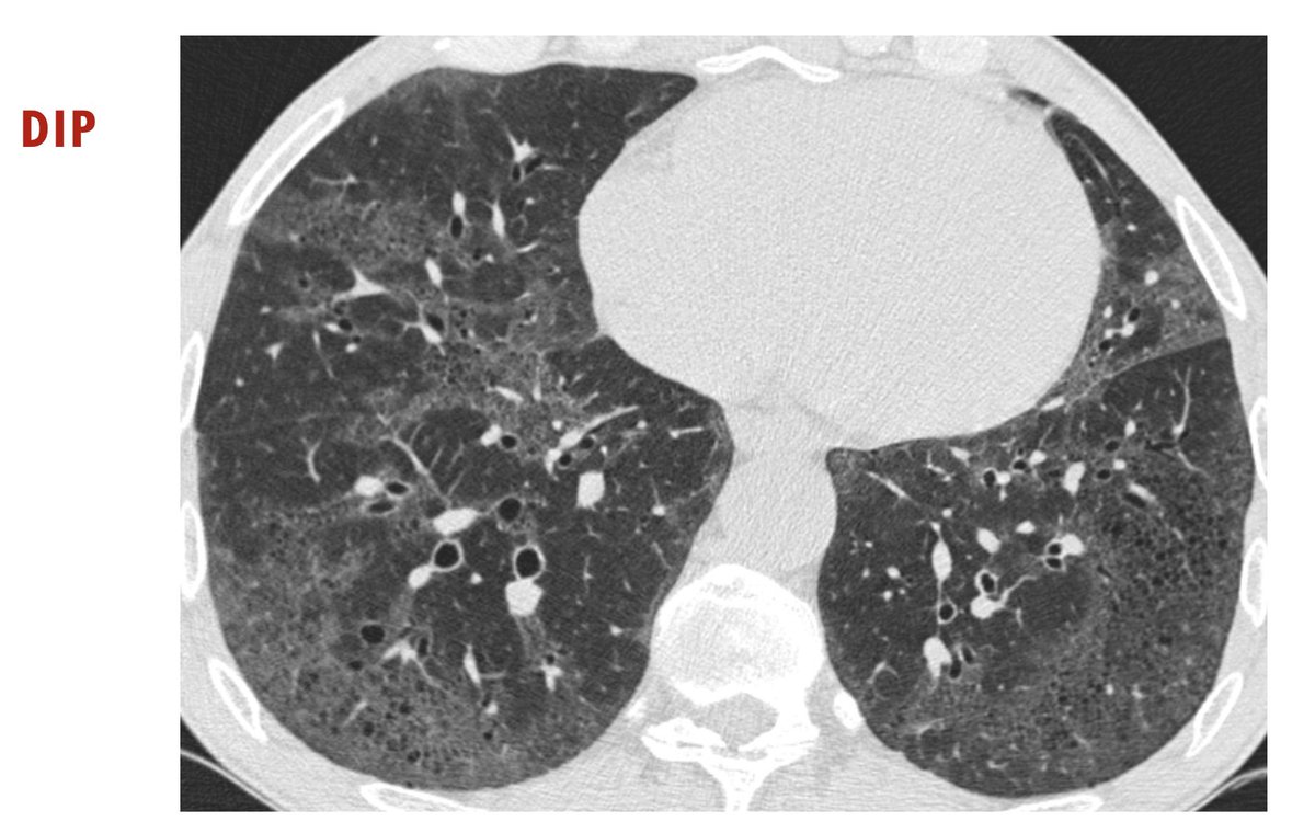 Interesting case of male 76 years old x smoker. What does this patient