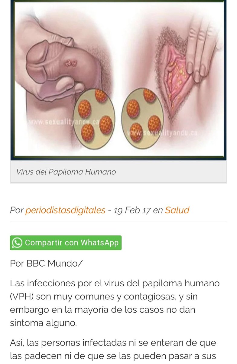 NorisMeza6's tweet photo. @LunaOsuna3 @yerimua Sii bryan dijo q le pegaban unas pelotitas en la pantufla https://t.co/InTiZzmmLc