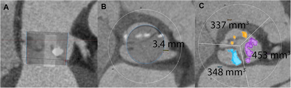 CathElectroSurg tweet picture