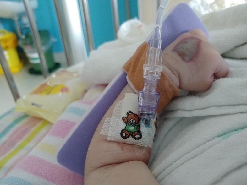 Amanda Ullman (@amanda_ullman) on Twitter photo Are you a clinician involved in identification & management of extravasations in Australian or NZ paediatrics?
Together, we can do better- please complete our survey:
uqpsych.qualtrics.com/jfe/form/SV_5g…
<a href="/AVATAR_grp/">AVATAR Group</a> <a href="/circan_network/">CIRCAN</a> <a href="/PaedSurg/">Craig McBride</a> <a href="/TriciaVAMS/">Tricia</a> <a href="/qldchildres/">Child Health Research Centre</a> <a href="/UQHealth/">UQ Health</a> <a href="/ChildUnLTD/">Child UnLimited</a> Are you a clinician involved in identification & management of extravasations in Australian or NZ paediatrics?
Together, we can do better- please complete our survey:
uqpsych.qualtrics.com/jfe/form/SV_5g…
<a href="/AVATAR_grp/">AVATAR Group</a> <a href="/circan_network/">CIRCAN</a> <a href="/PaedSurg/">Craig McBride</a> <a href="/TriciaVAMS/">Tricia</a> <a href="/qldchildres/">Child Health Research Centre</a> <a href="/UQHealth/">UQ Health</a> <a href="/ChildUnLTD/">Child UnLimited</a>