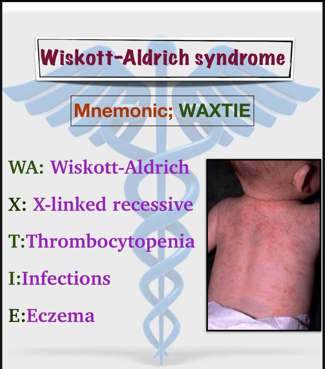 yoursmedico's tweet photo. Wiskott aldrich syndrome 
#MedEdChat #MedEd #medtwitter #MedTwitterSelective
#neetpg2022counselling #NEETUG2022 #neetug2022counselling #NEETPG2023 https://t.co/tTeVRhzzcJ
