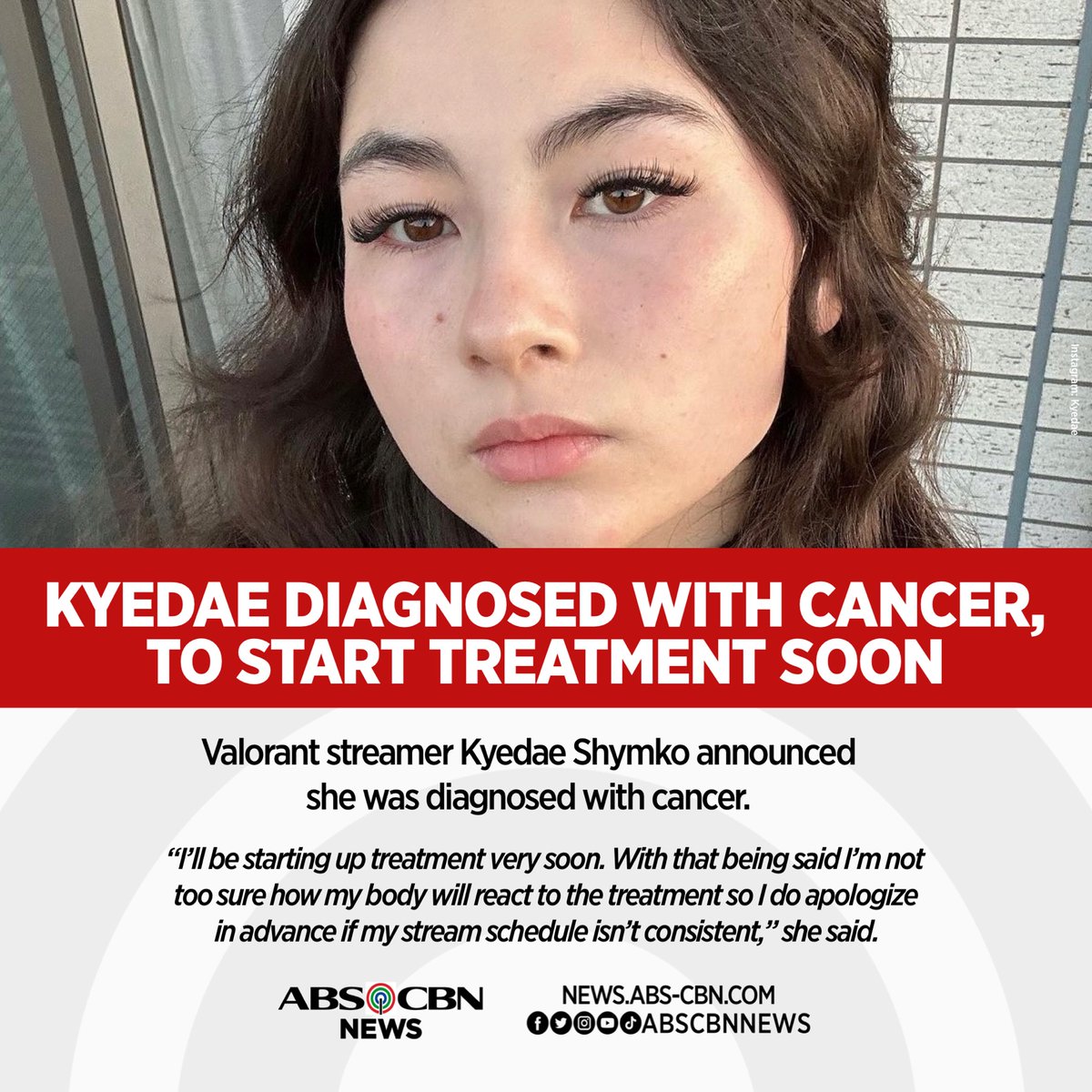ABSCBNNews's tweet photo. STAY STRONG, KYEDAE 🙏

The 100 Thieves streamer tweeted on Friday that she was diagnosed with acute myeloid leukemia. 

Read: https://t.co/XwumeGPUJz https://t.co/k732w3B1xx