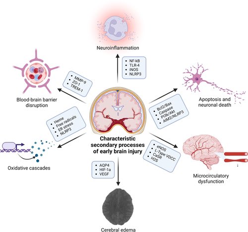 Early Brain Injury After Subarachnoid Hemorrhage: Incidence and Mechanisms ahajournals.org/doi/10.1161/ST…