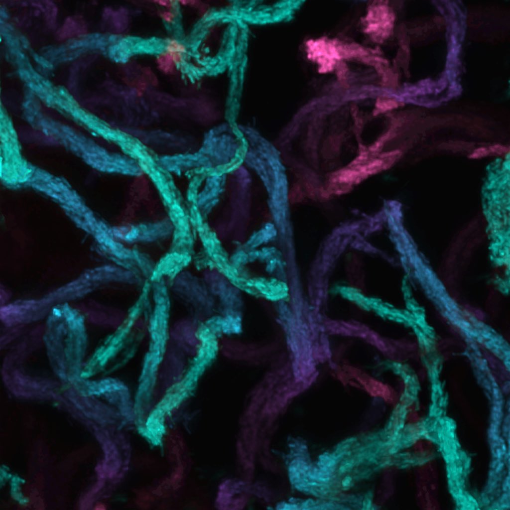Such a beautiful picture taken from mycobacterial #biofilm by Sanni Erämies from @TampereUniMET imaging core. Now it’s time to find out if #extracellularDNA affects biofilm morphology in #mycobacteria 🤨