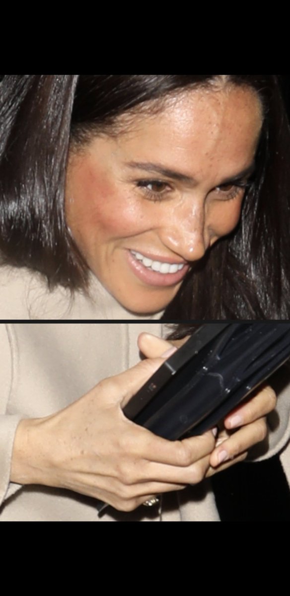msjoannerisdal's tweet photo. Haha her face is darker than her hands
#faketanfail https://t.co/kKWiMCWPMq