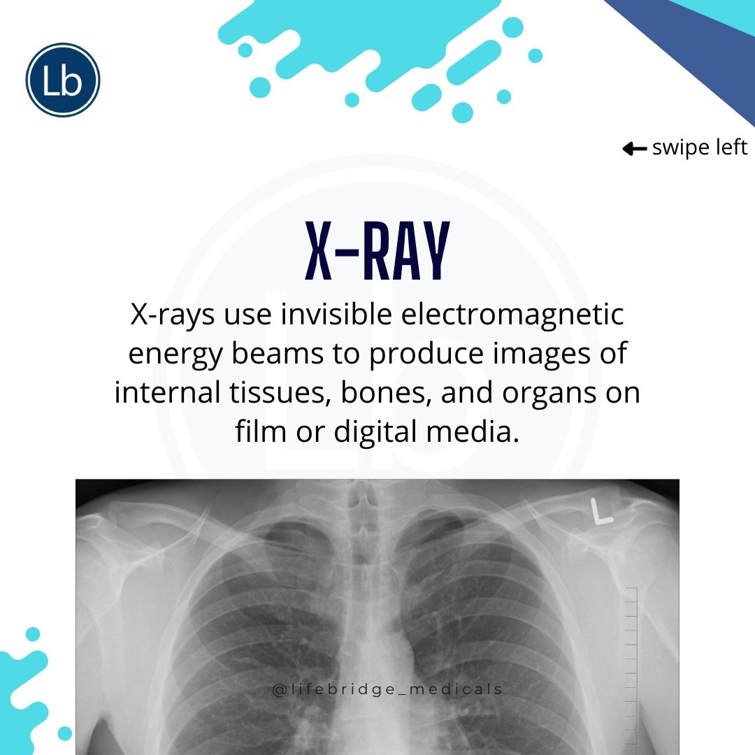 LifebridgeMDC's tweet photo. For your X-ray scans at affordable rates, visit lifebridge medical diagnostics centre. Our X-ray machine will give you the best results.
#xrays #imagine
#lifebridge #lifebridgehealth #lifebridgemedicals #abuja #abujaevents #health #covid_19 #covidtest #covidtesting #pcrscreening https://t.co/KUkb5XDuMR