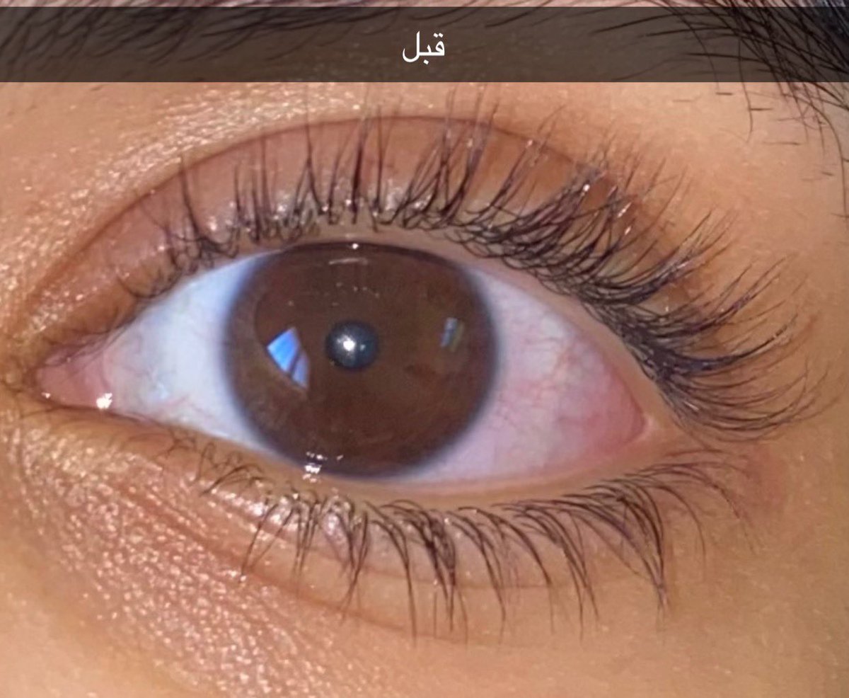 al_riv2's tweet photo. @mufidareal جربت قطرة كيربروست تجنن والله ومستمره عليها واستخدمها بعد للحواجب لي شهر وشوي بس الحقيقه طلعت لي سواد فوق الجفن بس نتايجها حلوه مره https://t.co/s8jnctutfA