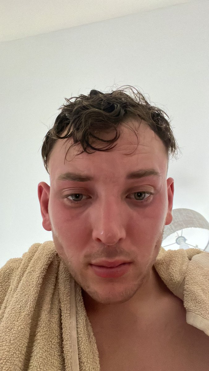 Knockentiber's tweet photo. There's no match for us this weekend - instead, our goalie Nathan Finnie is in the ring for a boxing bout tonight, and we wish him all the best! Just don't end up looking like this again, fella... https://t.co/LZCZ4fnB2w