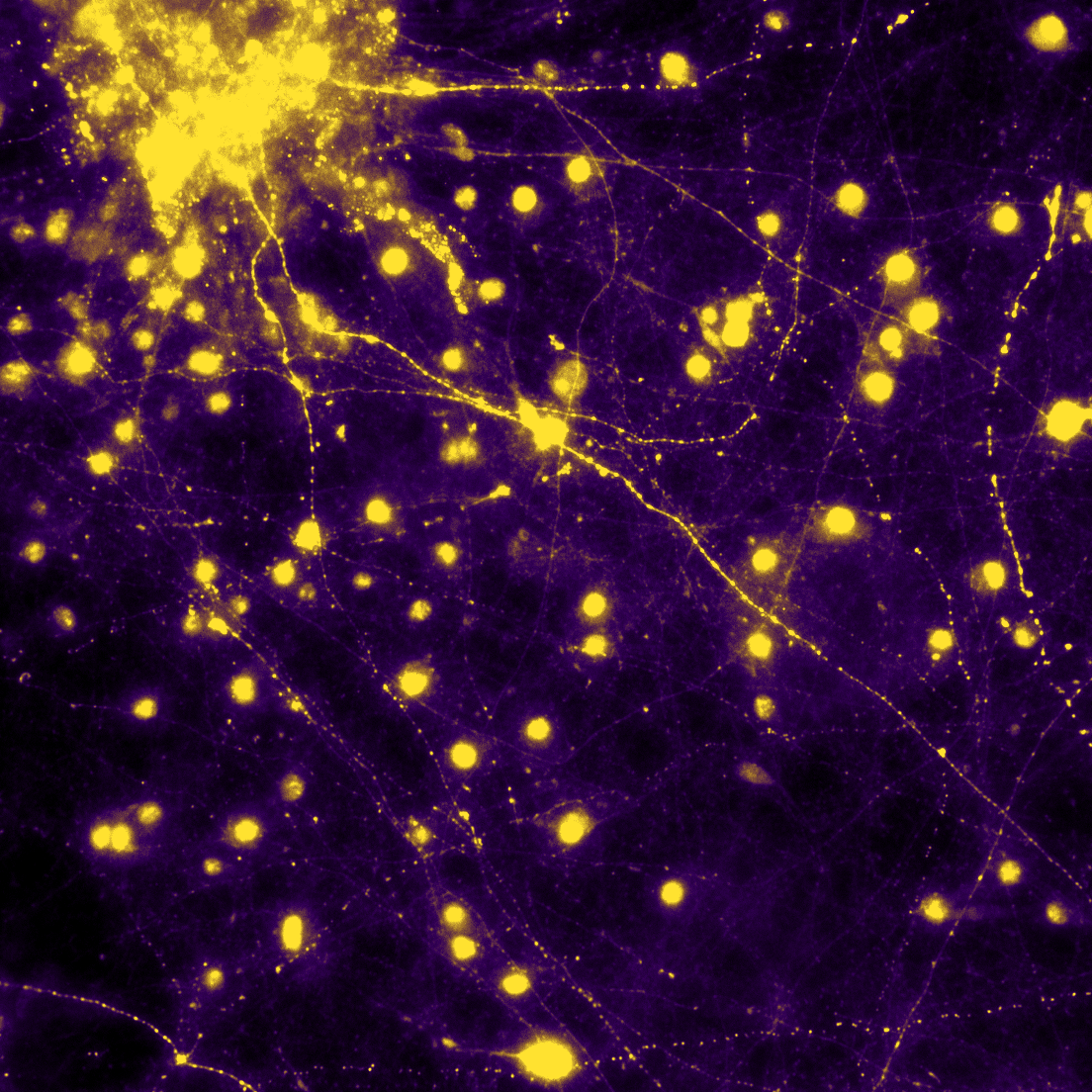 SinaiBrain's tweet photo. 🌩⚡Neurons of Lightning⚡🌩 Stem cell derived dopaminergic neurons grown for over 2 months & stained for tyrosine hydroxylase, a marker of dopaminergic neurons VOTE NOW #BlanchardLab's @chamomeleon123's #ArtoftheBrain #CallforImages #23 Most💘s wins! #BAW2023 #BrainAwarenessWeek https://t.co/1BX767W87B