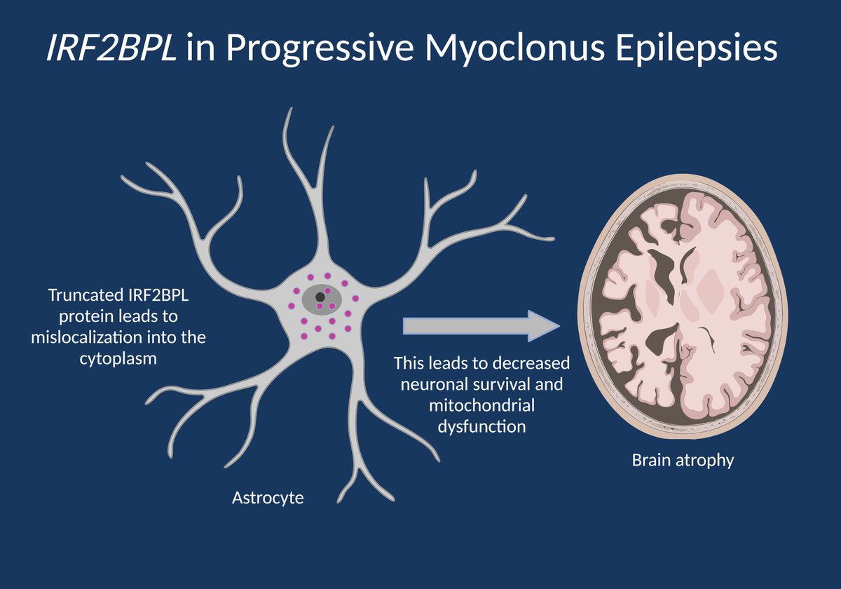 IRF2BPL in progressive myoclonus epilepsy – an unexpected phenotypic discovery | Beyond the Ion Channel 

epilepsygenetics.net/2023/03/03/irf…