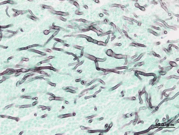 This review covers the pharmacology and antimicrobial spectrum of antifungal drugs used in the systemic treatment of pulmonary fungal diseases, highlighting the clinical trial data supporting targeted treatment of specific disease entities.

#IDTwitter 

bit.ly/418Fd0Y