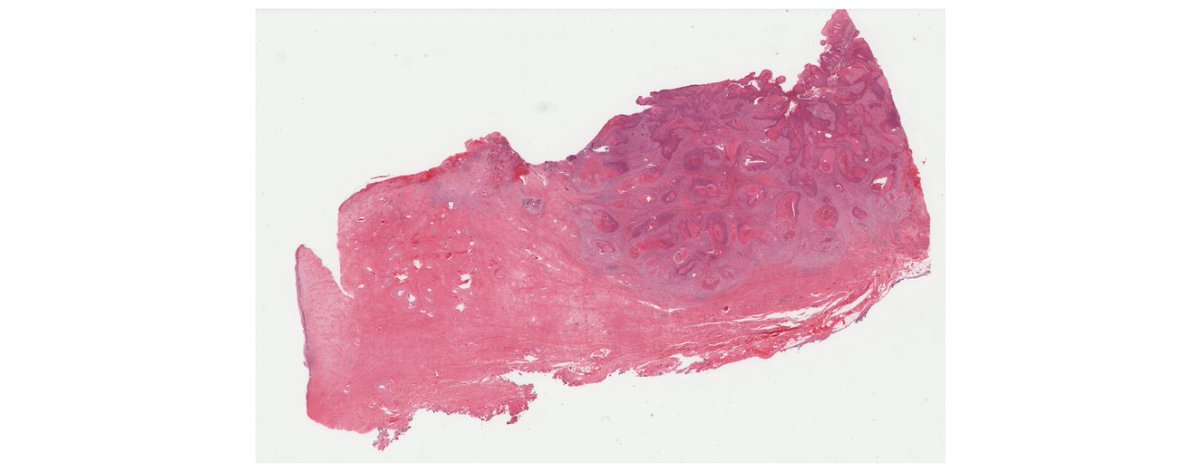 We’re developing an #ArtificialIntelligence #BloodCancer diagnostics tool. 

It will help reduce #haematopathologist workload burden, but we need help to reach this goal sooner.

Get in touch!

#HealthcareChallenges #Pathology #StartupInvestor #InvestInAI