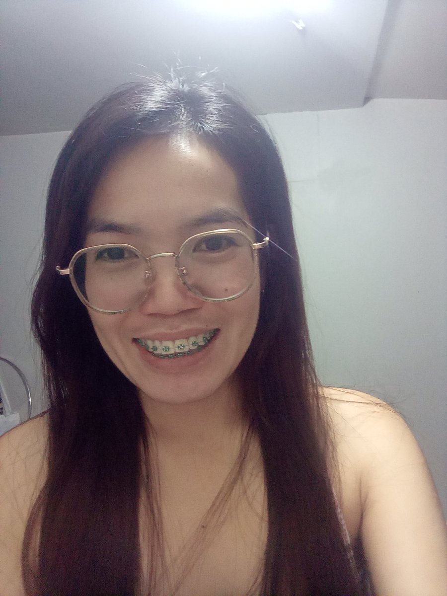 Rolieme22's tweet image. 83rd day of braces 😁

#overbite