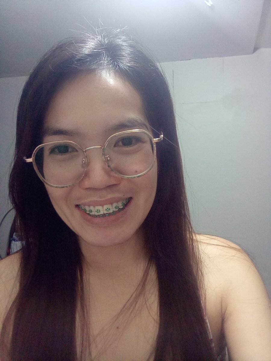 Rolieme22's tweet image. 83rd day of braces 😁

#overbite