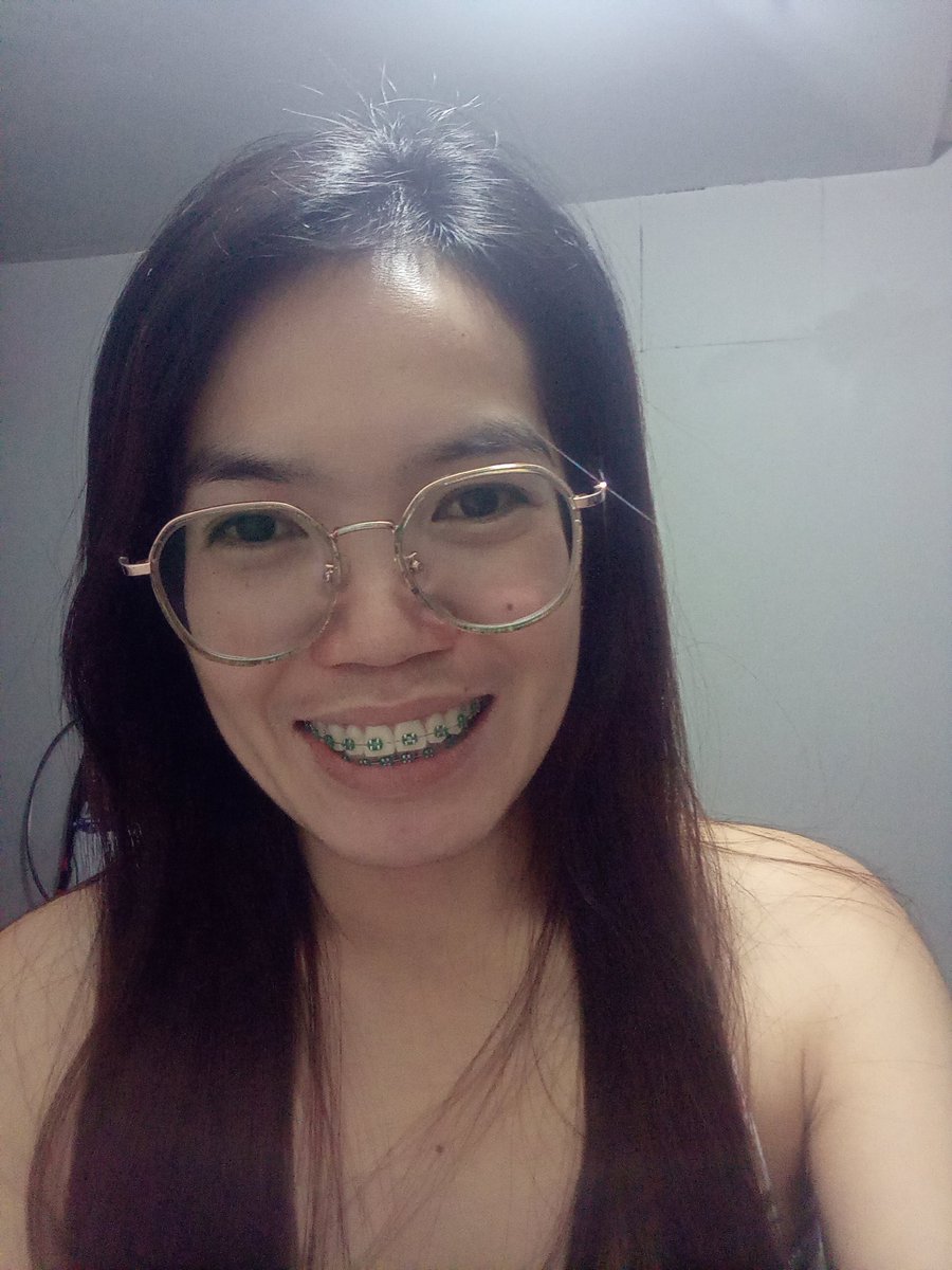 Rolieme22's tweet image. 83rd day of braces 😁

#overbite