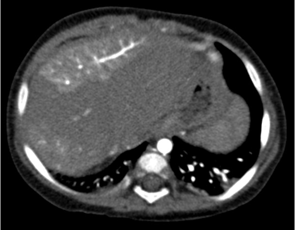 Lurie Children’s Radiology tweet media