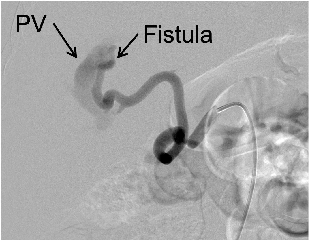 Lurie Children’s Radiology tweet media