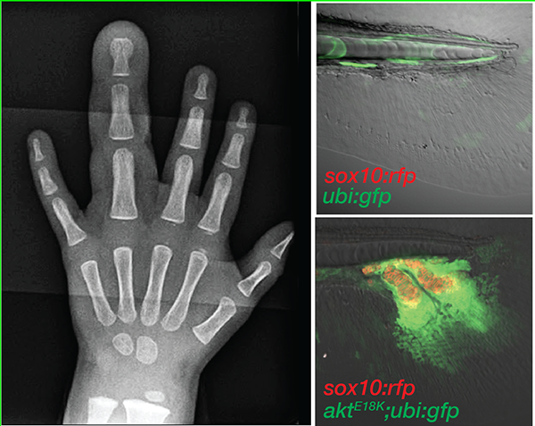 Ironic how the theme of the work is timing and I am exhibiting poor mastery of that... Fabulous work by Nicola Blum to understand factors that shape coordinated growth of somatic clones, modeling human overgrowth syndromes in zebrafish.  Opening up new areas for disease modeling!