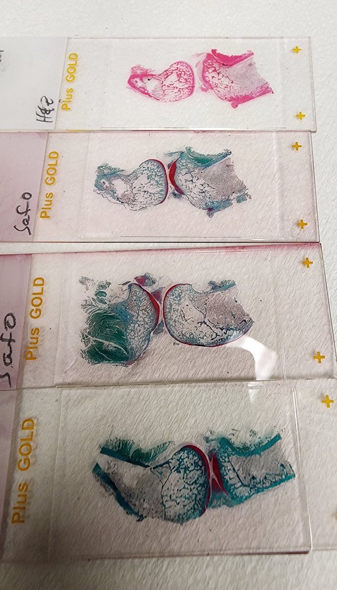 JAFretz's tweet photo. What am I cutting in the Histology/Histomorphometry lab today:
Knees at different depths to determine efficacy of new arthritis treatments
#ortho #histology #bonejoint #bones
@OrthoAtYale https://t.co/nntVZRkANr