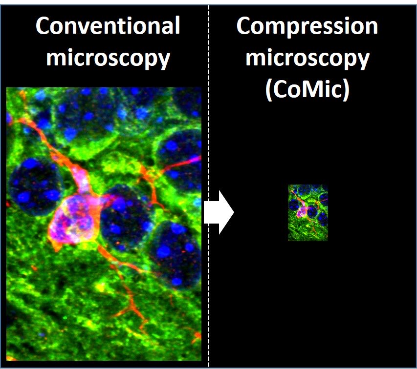 🇺🇦TønnesenLab (@toennesen) on Twitter photo We present Compression #Microscopy (CoMic) as a new #superres modality. By compressing the sample it is made inaccessible by conventional imaging, thus necessitating superres. CoMic allow imaging of macro-structures by superres, and could make diffraction-limited imaging obsolete We present Compression #Microscopy (CoMic) as a new #superres modality. By compressing the sample it is made inaccessible by conventional imaging, thus necessitating superres. CoMic allow imaging of macro-structures by superres, and could make diffraction-limited imaging obsolete
