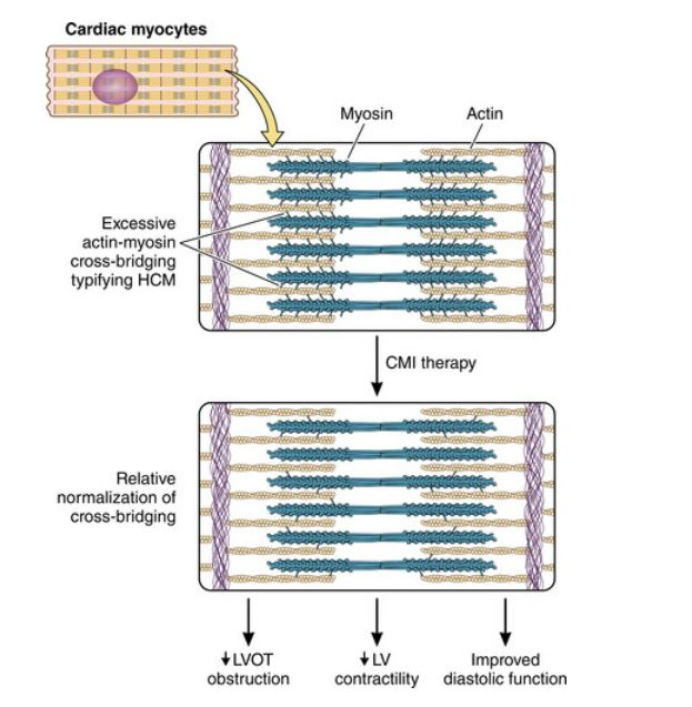 CircAHA's tweet photo. #CircAHA Cardiac Myosin Inhibition: A Targeted Therapeutic Option in Hypertrophic Cardiomyopathy #HCM  New #Perspective from  @AwangDukeU #AHAJournals https://t.co/FoQsmNOq1Z https://t.co/9kZbpAC5ur