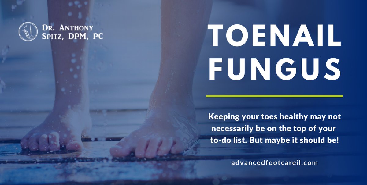 Keeping your toes healthy may not be at the top of your list, but maybe it should! See how fungal toenails affect your overall health. #podiatry #podiatrist #podiatristsofinstagram #podiatristinwheeling #wheelingillinois #footclinic #footclinicinwheeling  #footcare #footcaretips