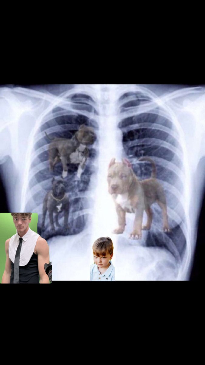 <a href="/A_Clemens05/">Aiden Clemens</a> let them hang today. W 5-0 vs <a href="/BarstoolFM/">Barstool Flower Mound</a> #prayforbruce