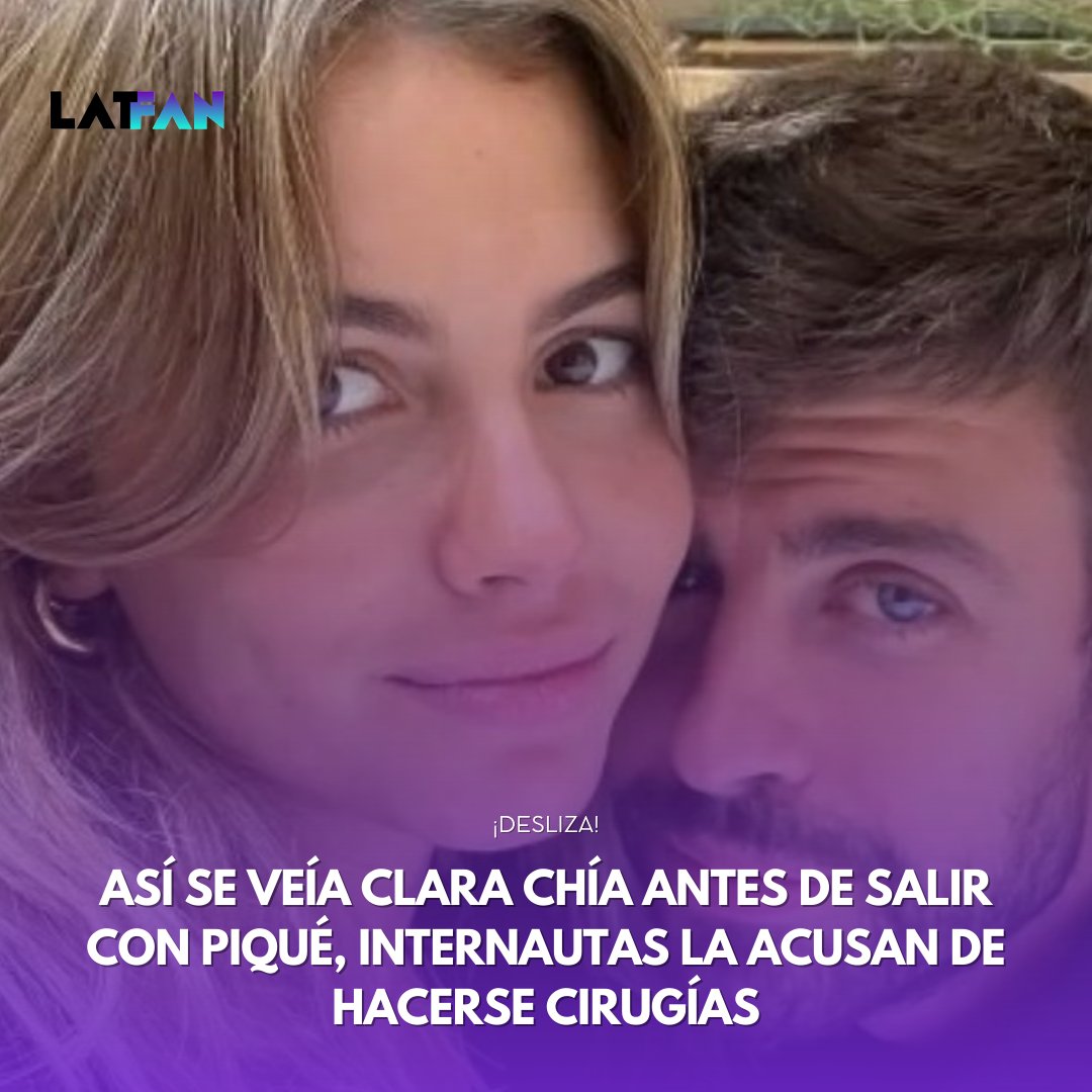 latfan_com's tweet photo. Una cuenta de Twitter, que se declara fan de la nueva pareja, posteó una imagen de Clara  Chía cuando la joven tenía 20 años, pero luce muy diferente de como se ve actualmente. Muchos internautas aseguran que ya se hizo varias cirugías para mejorar su aspecto. https://t.co/EJ5m2X5BDR