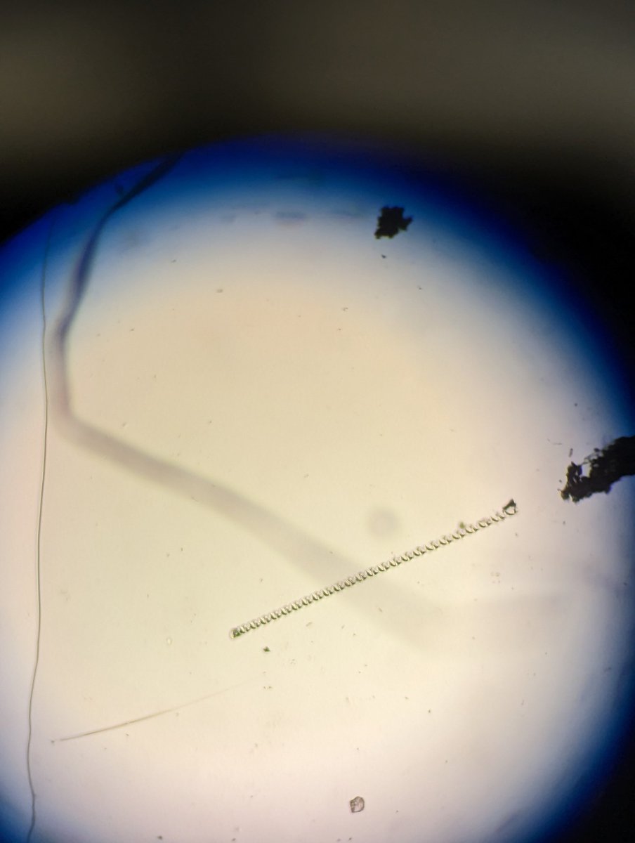 McNeishAqEcoLab's tweet photo. Does anyone have an idea on what this spiral looking item is? Students were identifying better plankton and an introductory lab and came across it. The sample came from a pond and the photo is at 100x magnification. https://t.co/BdkzYWahDF