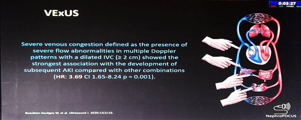 BeheraVineet's tweet photo. Dr Abhilash Koratala @KoraAbhi speaks on #POCUS #ICU at @critcareneph23 @NephroP
#VEXUS
#StrokeVolume Assessment
#criticalcarenephrologyindia #pcrrtadvances #critcareneph23
@sidsdoc @drshyambansal https://t.co/FbPDZDbPHj