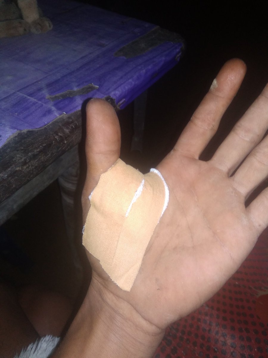 Beginilah kerjaan gw,ngantuk dikit 5 jaitan
Untung murah cuma 60 rebu, tapi di jait pake rambut barbie