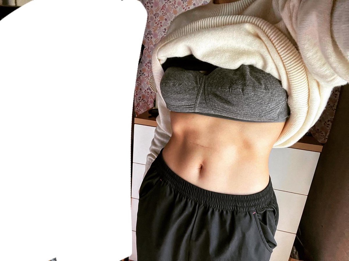 K_biomechanics's tweet image. トレ後の三角筋・上腕三頭筋良い感じ💪
腹筋も絞りが効いてきてる☺️

明日はRest日にして筋肉の回復に努めよ😴

#ボディメイク
#筋トレ好きと繋がりたい
#6pack