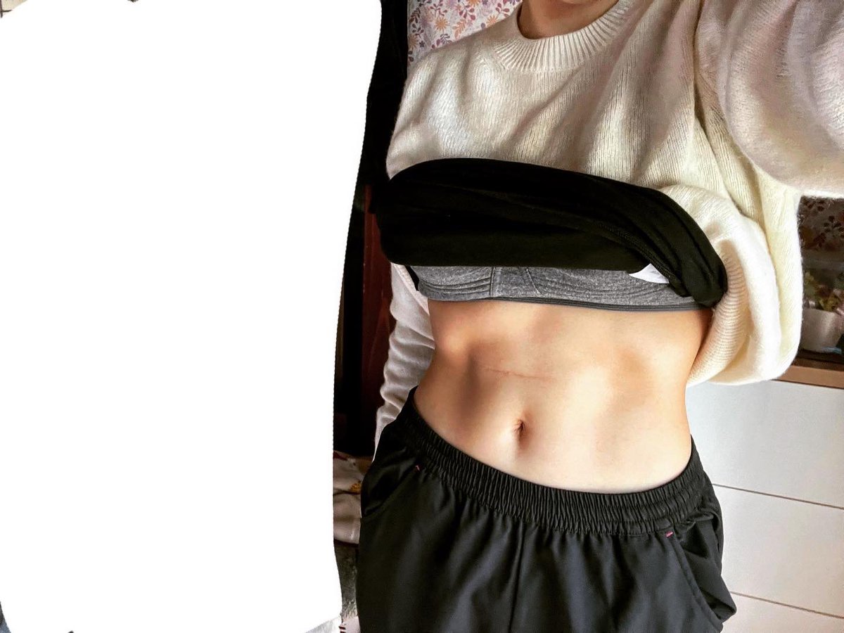 K_biomechanics's tweet image. トレ後の三角筋・上腕三頭筋良い感じ💪
腹筋も絞りが効いてきてる☺️

明日はRest日にして筋肉の回復に努めよ😴

#ボディメイク
#筋トレ好きと繋がりたい
#6pack