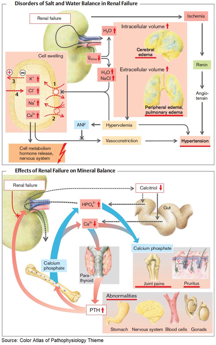 Manual Of Medicine on Twitter "Effects of Renal Failure on Water and