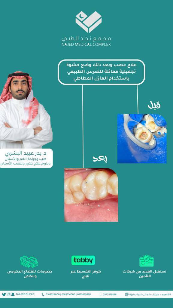 بعض من إبداعات دكتور بدر البشري تسلم على هالشغل 👏🏽🌷

#مجمع_نجد #القصيم #عنيزة #نجد_الطبي
#مجمع_نجد_الطبي_في_عنيزة