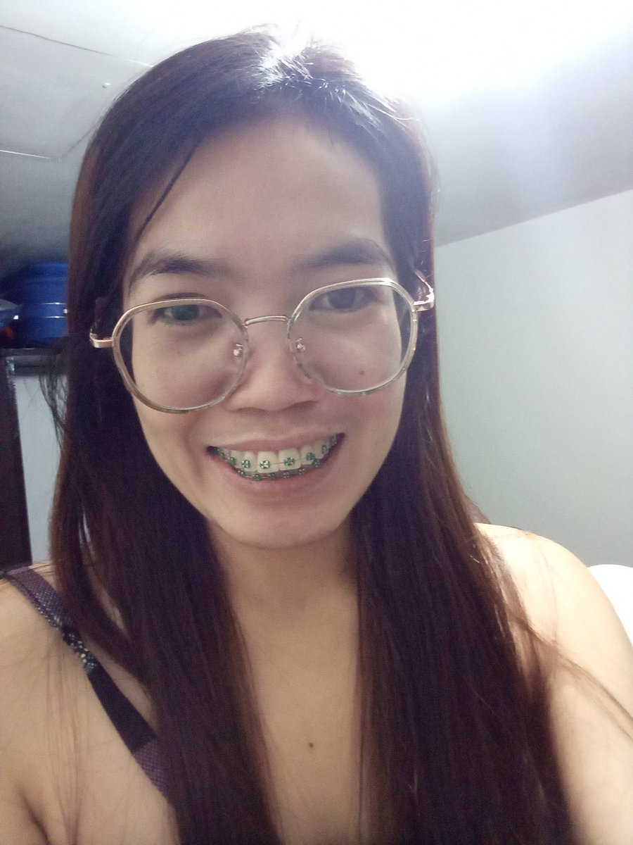 Rolieme22's tweet image. 84th day of braces 😁

#overbite