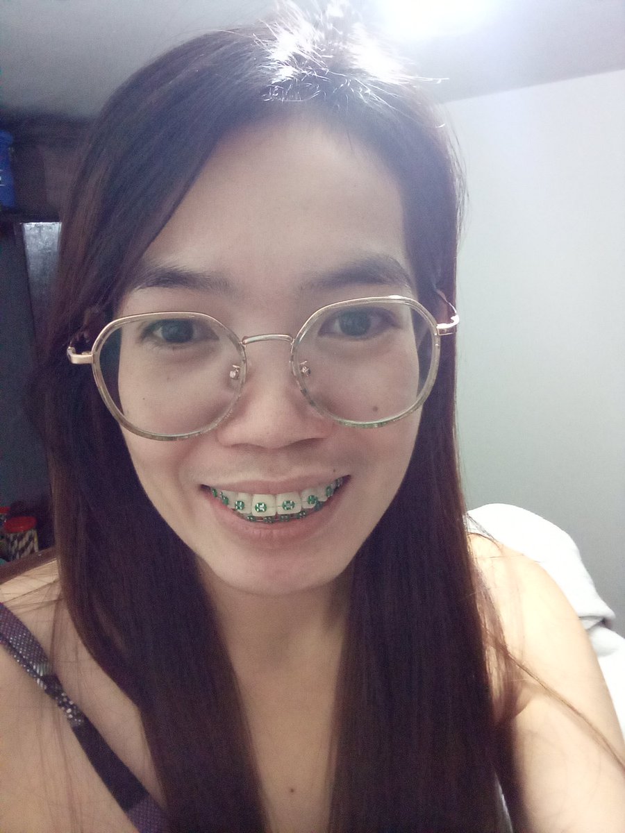Rolieme22's tweet image. 84th day of braces 😁

#overbite