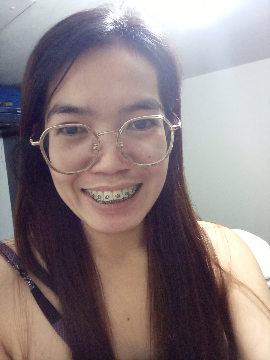 Rolieme22's tweet image. 84th day of braces 😁

#overbite
