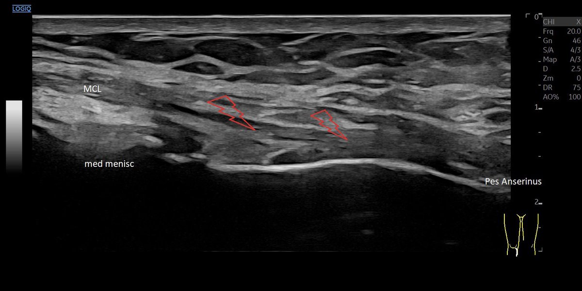 Dr Jörg Dünkel tweet media