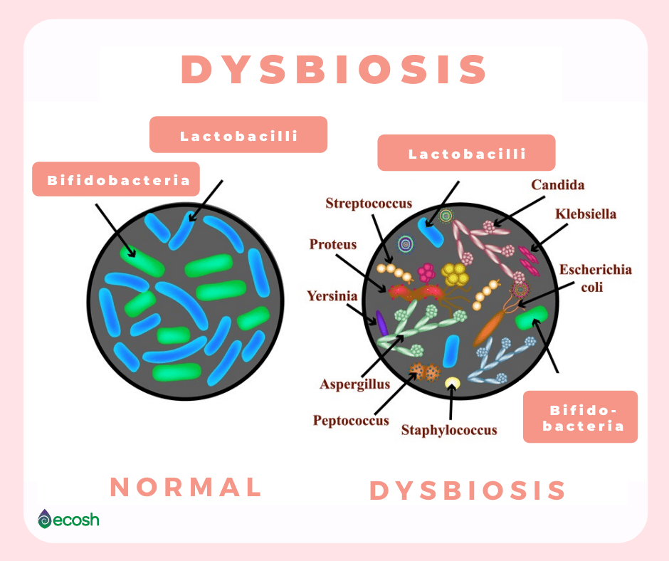 What Does Dybosia Mean