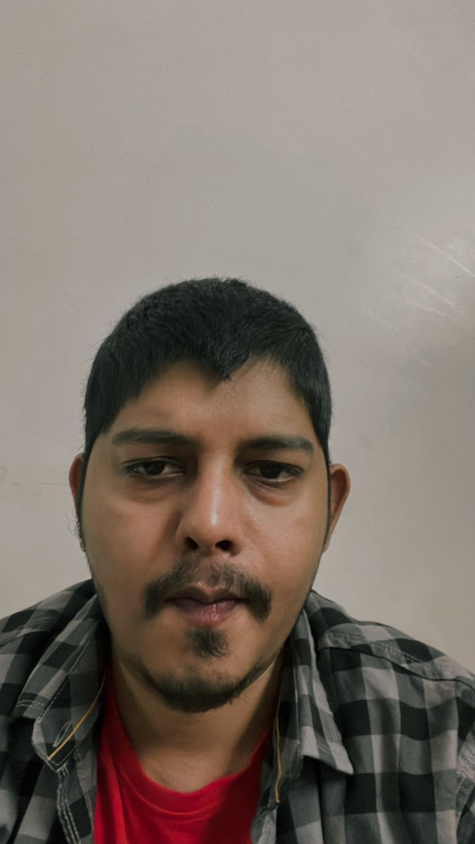 chaibuoy's tweet photo. My hairline have started to look like Mcd logo🤠 https://t.co/5Vxs3u5lNI