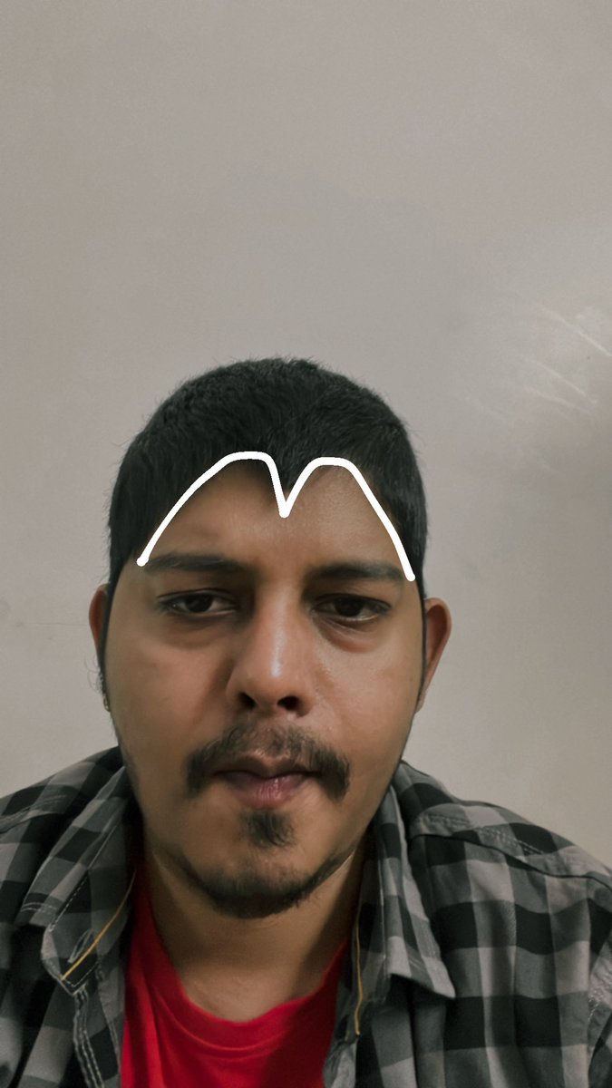 chaibuoy's tweet photo. My hairline have started to look like Mcd logo🤠 https://t.co/5Vxs3u5lNI