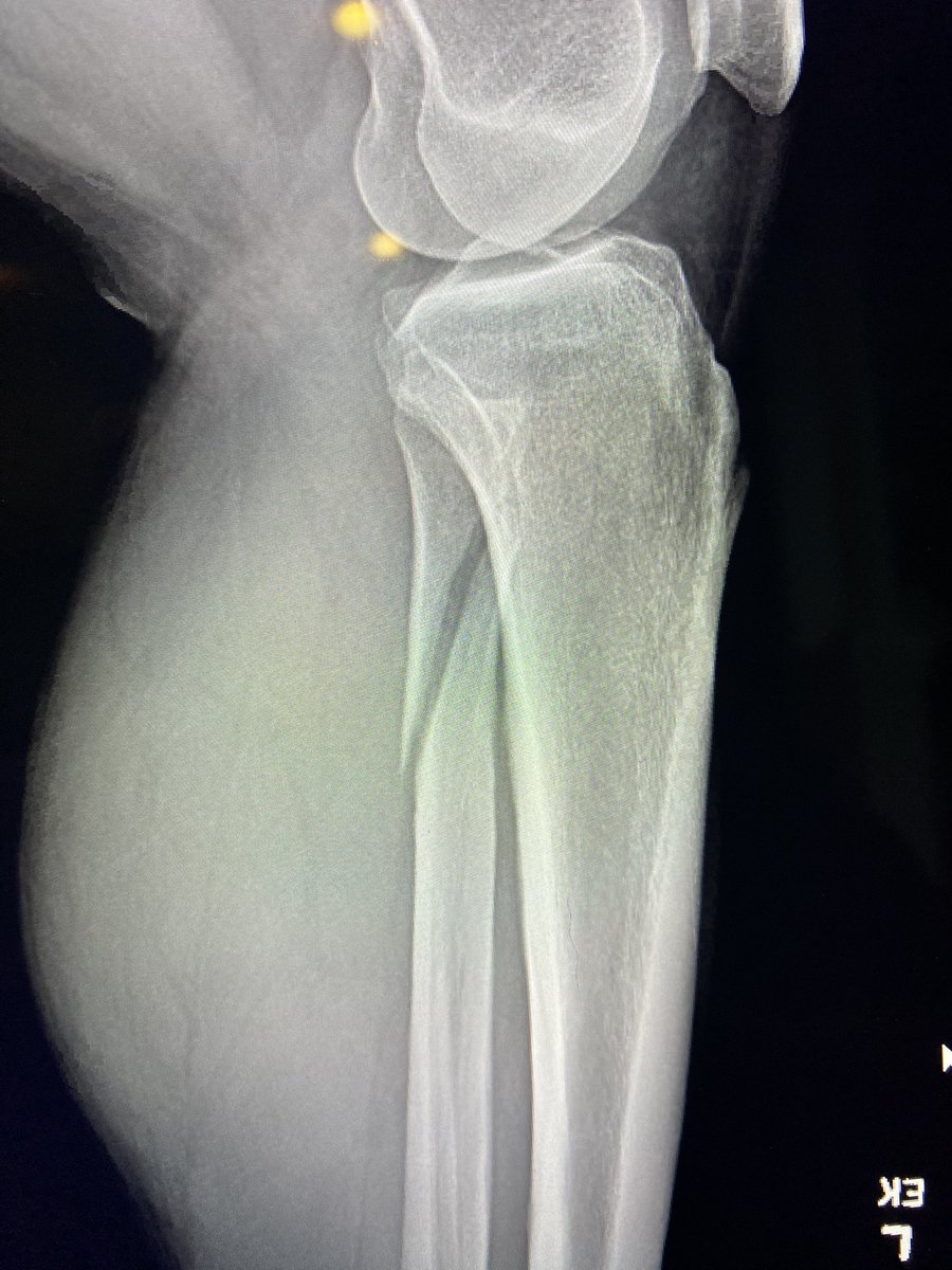 Jason Rudolph, MD, FAAOS tweet media