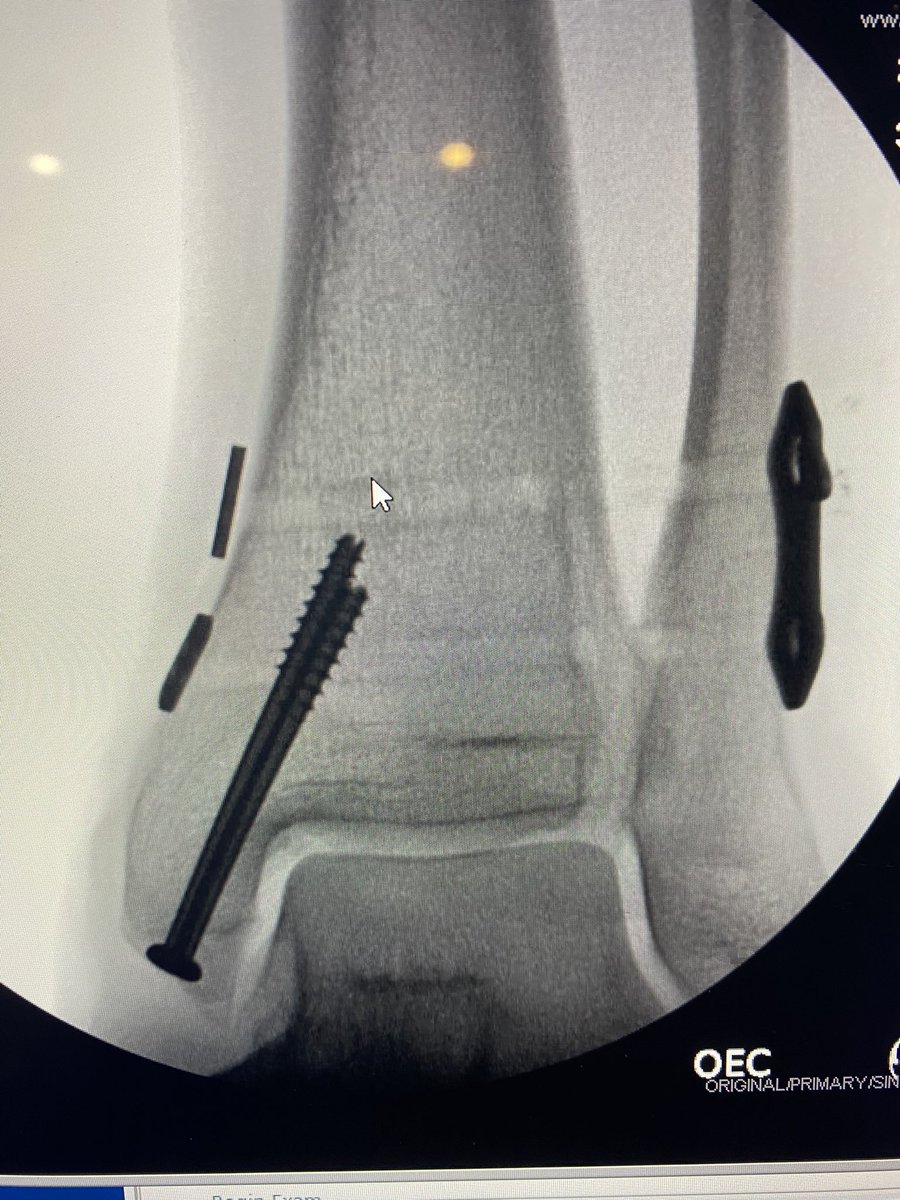 Jason Rudolph, MD, FAAOS tweet media