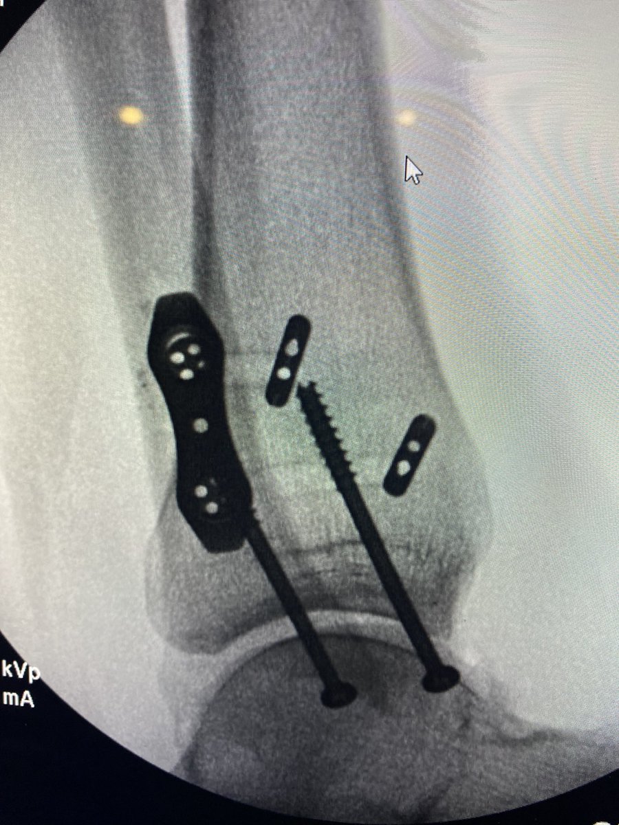 Jason Rudolph, MD, FAAOS tweet media