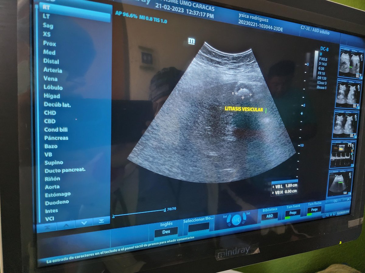 ¡Cuentas con este equipo!

Para lograr este objetivo, se apoyó a cada paciente con el proceso preoperatorio.

En total, fueron 2698  exámenes.

#ChavezInfinito