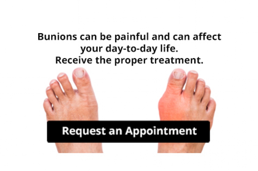 ChicagoSurgeons's tweet photo. Are Bunions Affecting Your Everyday Life? https://t.co/5Muqz7xHXI https://t.co/1crNzlnMjv