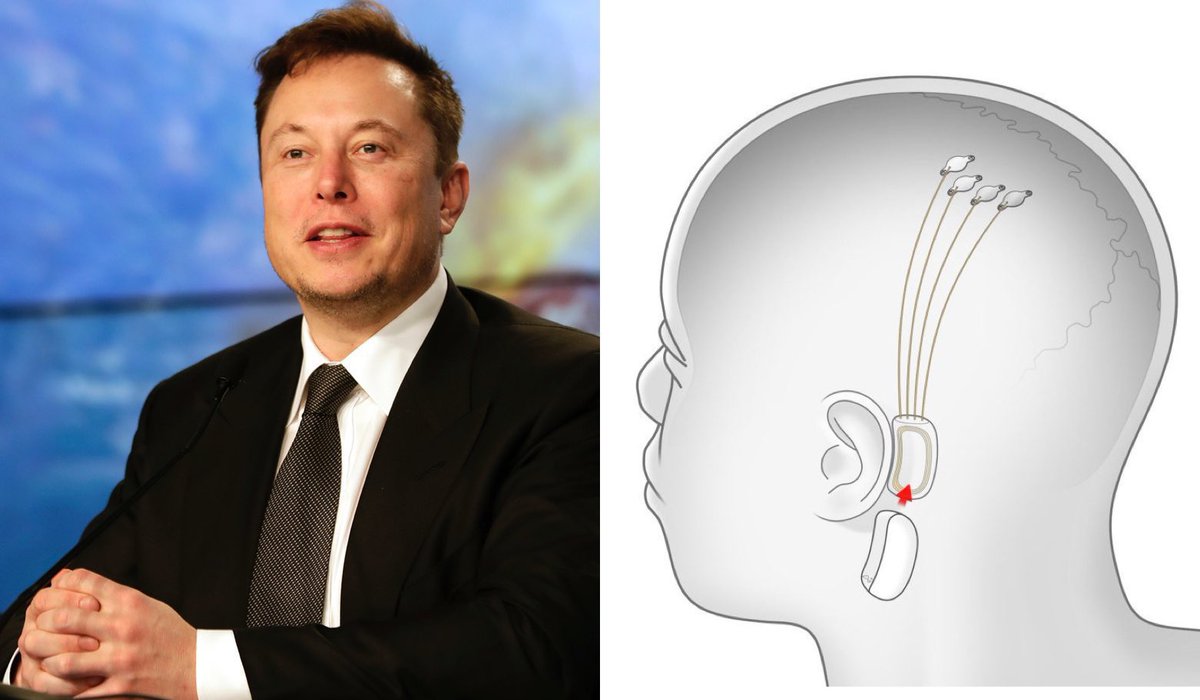 US regulators rejected Elon Musk’s plan to test brain chips in humans.