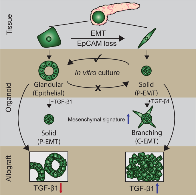 Organoid News (@organoidscience) on Twitter photo Led by <a href="/RRJLow/">Ronnie Ren Jie Low</a> at @PutoczkiLab, a <a href="/WEHI_research/">WEHI (Walter and Eliza Hall Institute)</a> team and collaborators used a lineage-traced sporadic model of #PancreaticCancer to study how S100 family proteins are linked to #organoid morphology and EMT in pancreatic cancer.
π <a href="/cddpress/">CDD press</a> | go.nature.com/3Ys71eo Led by <a href="/RRJLow/">Ronnie Ren Jie Low</a> at @PutoczkiLab, a <a href="/WEHI_research/">WEHI (Walter and Eliza Hall Institute)</a> team and collaborators used a lineage-traced sporadic model of #PancreaticCancer to study how S100 family proteins are linked to #organoid morphology and EMT in pancreatic cancer.
π <a href="/cddpress/">CDD press</a> | go.nature.com/3Ys71eo