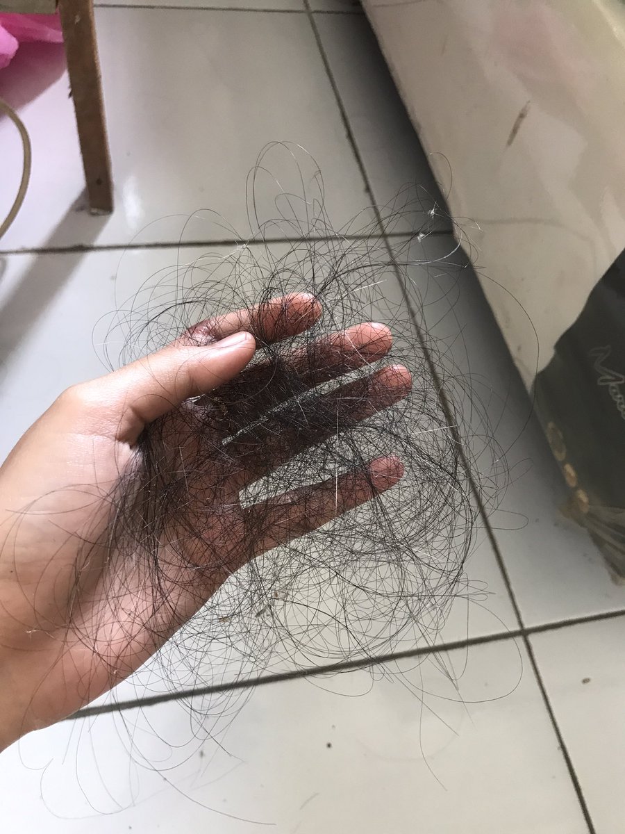 iralujianty's tweet photo. Normal gak sih tiap hari rambut rontok segini banyak? Trus bejatuhan di lantai dimana mana https://t.co/04vxL9I6AZ